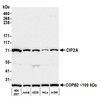 CIP2A Antibody