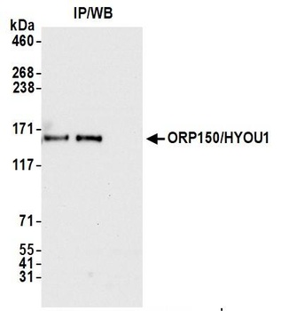 ORP150/HYOU1 Antibody