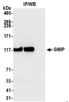 GMIP Antibody