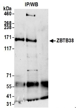 ZBTB38 Antibody