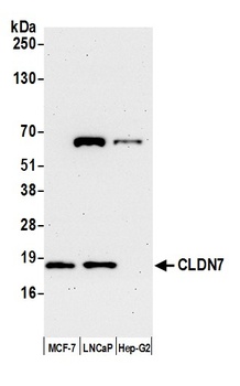 Rabbit CLDN7 Antibody
