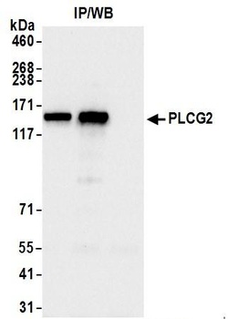 PLCG2 Antibody