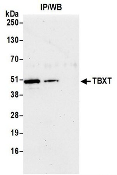 TBXT Antibody