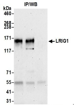 LRIG1 Antibody