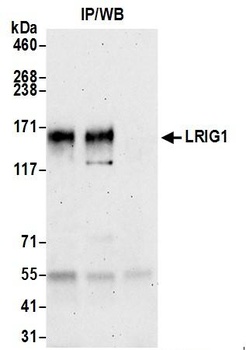Rabbit anti-LRIG1 Antibody