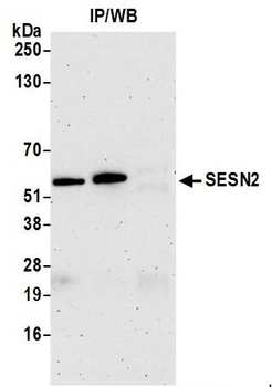 SESN2 Antibody