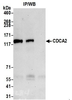 Rabbit anti-CDCA2 Antibody