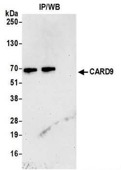 Rabbit anti-CARD9 Antibody