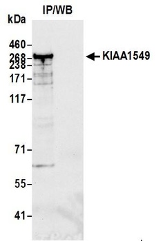 Rabbit anti-KIAA1549 Antibody