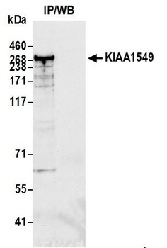 KIAA1549 Antibody