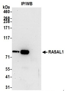RASAL1 Antibody