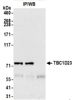 Rabbit anti-TBC1D23 Antibody