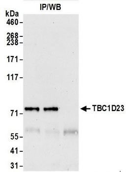 TBC1D23 Antibody