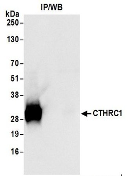 Rabbit anti-CTHRC1 Antibody