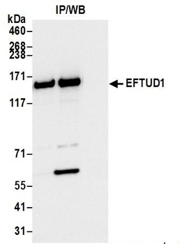 Rabbit anti-EFTUD1 Antibody