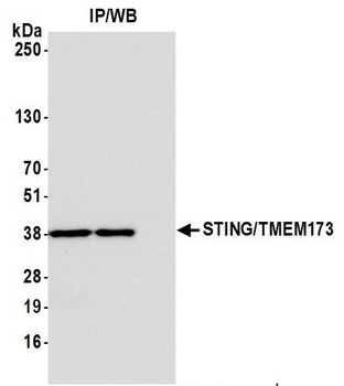 STING/TMEM173 Antibody