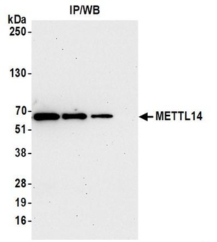 METTL14 Antibody