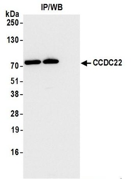 Rabbit anti-CCDC22 Antibody