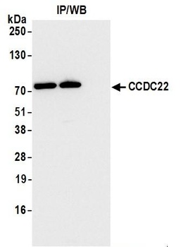 CCDC22 Antibody