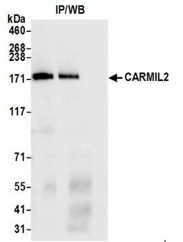 CARMIL2 Antibody