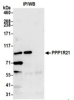 Rabbit anti-PPP1R21 Antibody