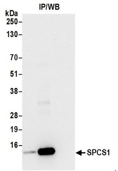 Rabbit anti-SPCS1 Antibody