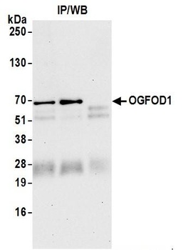 OGFOD1 Antibody