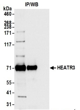 HEATR3 Antibody