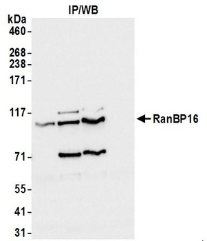 RanBP16 Antibody