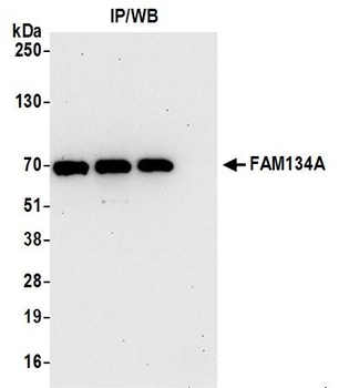 FAM134A Antibody