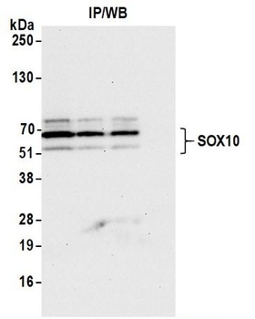 Rabbit SOX10 Antibody