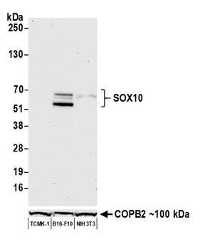 Rabbit SOX10 Antibody