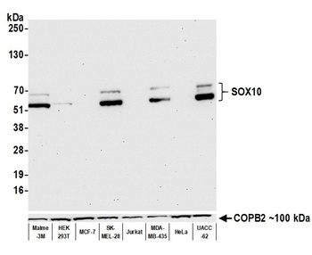 Rabbit SOX10 Antibody