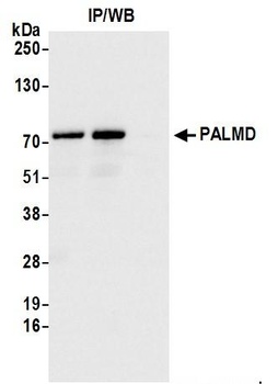 Rabbit anti-PALMD Antibody