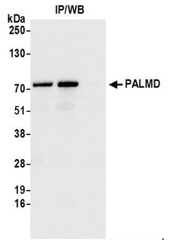 PALMD Antibody