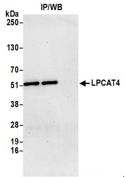 Rabbit LPCAT4 Antibody