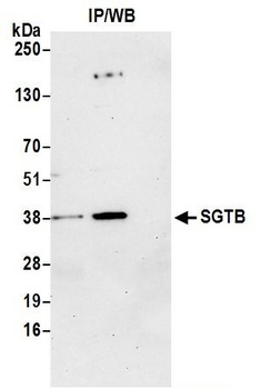Rabbit SGTB Antibody