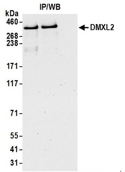DMXL2 Antibody