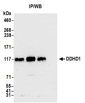 DDHD1 Antibody