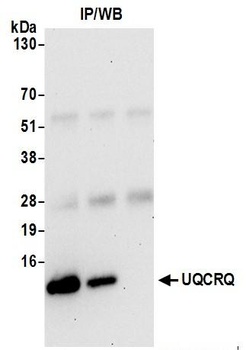 Rabbit anti-UQCRQ Antibody