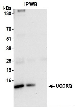 Rabbit anti-UQCRQ Antibody