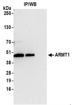 ARMT1 Antibody