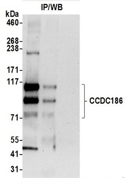 CCDC186 Antibody