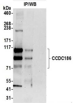 Rabbit anti-CCDC186 Antibody