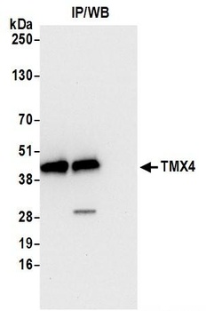 TMX4 Antibody