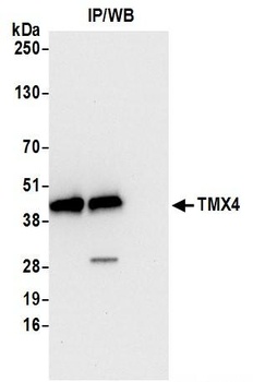Rabbit anti-TMX4 Antibody