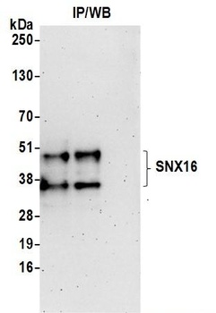 SNX16 Antibody