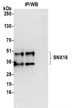 Rabbit anti-SNX16 Antibody