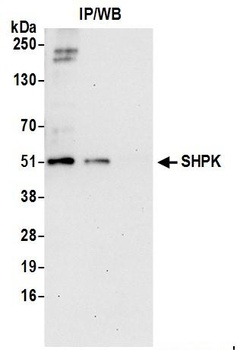 Rabbit SHPK Antibody