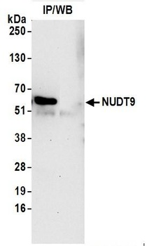 NUDT9 Antibody